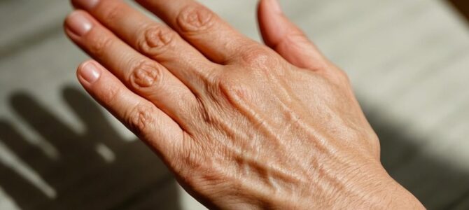 Truco para evitar que su piel se reseque en invierno Truco para evitar que su piel se reseque en invierno