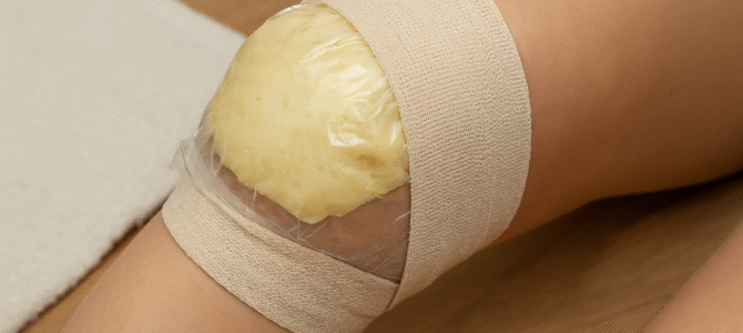 Un viejo truco que actúa rápidamente contra la inflamación, el dolor y la hinchazón en las articulaciones Un viejo truco que actúa rápidamente contra la inflamación, el dolor y la hinchazón en las articulaciones