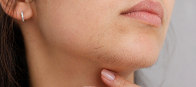 Cómo el estrés y la alimentación influyen en el crecimiento de vello en el mentón en mujeres