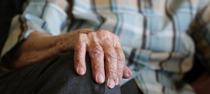 Cómo atenuar las manchas de la edad en la piel: 5 métodos naturales y consejos prácticos