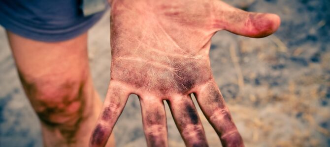 El secreto de tu personalidad podría estar en los dedos de tu mano izquierda El secreto de tu personalidad podría estar en los dedos de tu mano izquierda