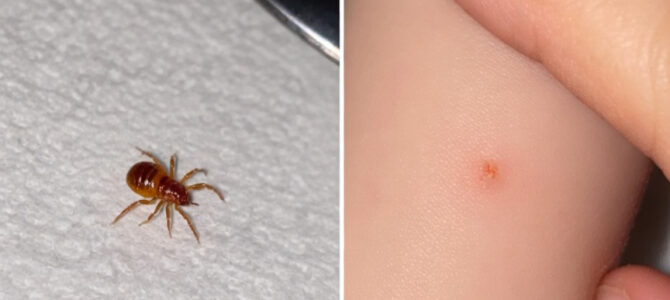 Pequeña criatura roja en el brazo de un bebé: qué es el ácaro rojo del trébol y si es peligroso